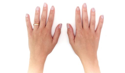 A top view of female hands with a wedding ring flat on a white surface