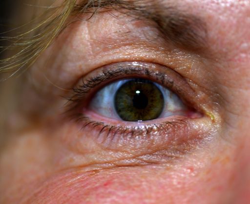A close-up of a green-eyed blond woman's eye