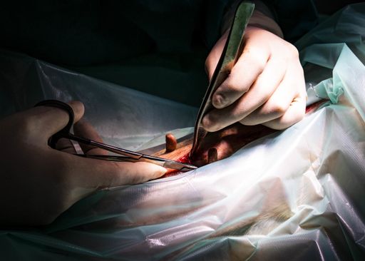 A closeup shot of doctors hands working on a surgery