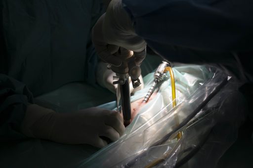 A closeup shot of hands with surgical instruments during a surgical process on the dark background