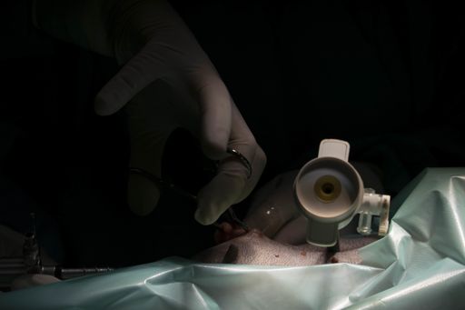 A closeup shot of a hand operating with surgical instruments on the dark background