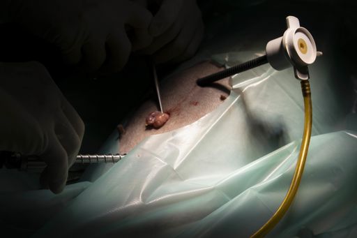 A closeup shot of a surgical process with surgical instruments on the dark background