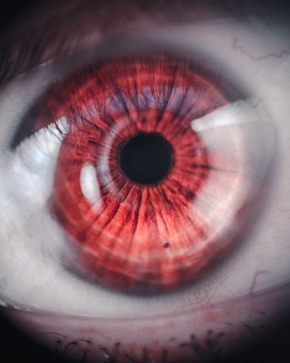 A closeup shot of an expressive red eye