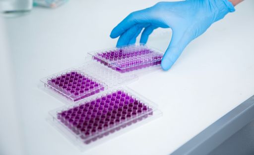 The scientist's hand taking one of the laboratory microplates filled with purple liquid. Microbiology.