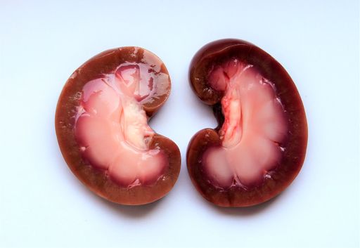 A top view of a sliced kidney on a white surface