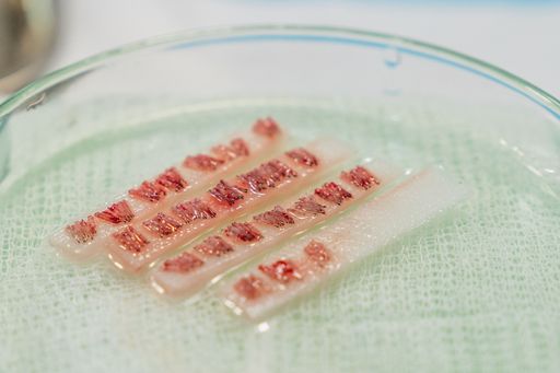 A selection of follicular units organized in a container for hair transplant.