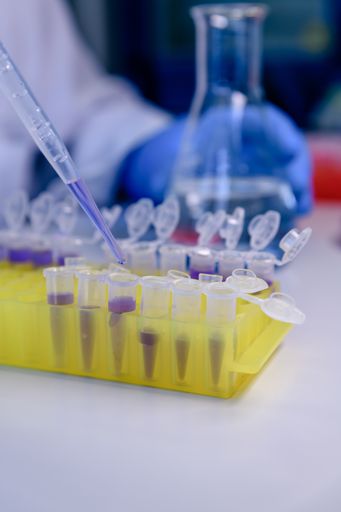 A vertical closeup shot of a person doing a coronavirus test with pipettes