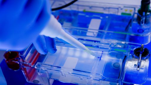 A closeup shot of a scientist conducting the gel electrophoresis biological process as part of coronavirus research