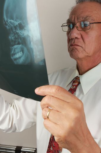 A healthcare provider thoughtfully examining X-ray results for treatment planning.
