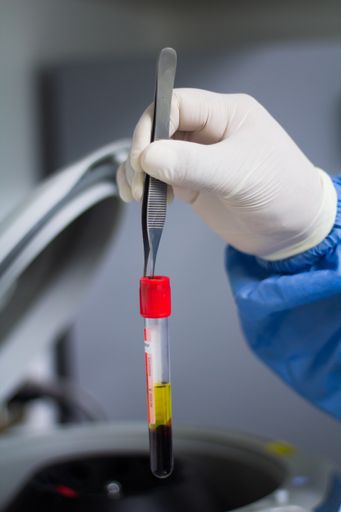 A shallow focus of a male hand with medical glove holding a tweezer to holding a covid test with blood