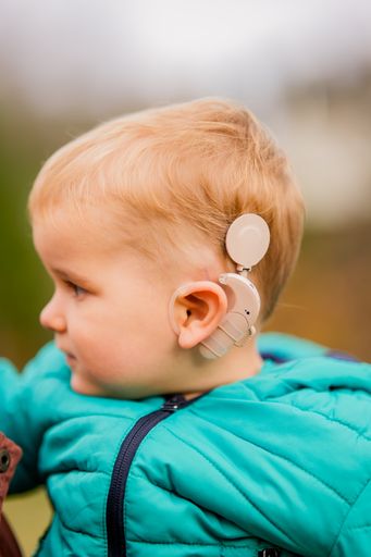A shot of a baby with cochlear implants