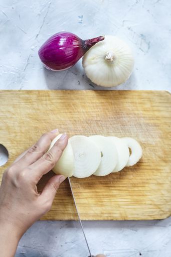 A vertical shot of a person slicing the onions on the cutting board