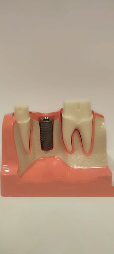 A vertical shot of dental instruments - prosthetics, invisalign, anesthesia syringe, silicone